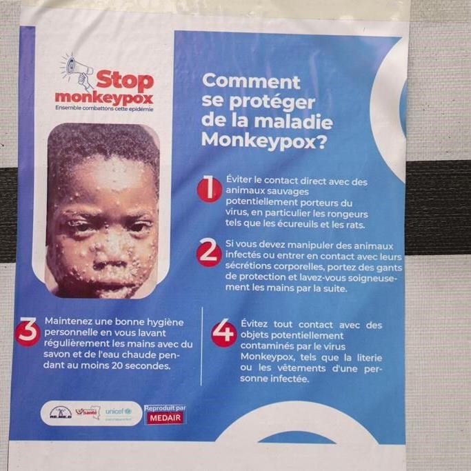 Sweden reports 1st case of more infectious form of mpox first identified in Congo